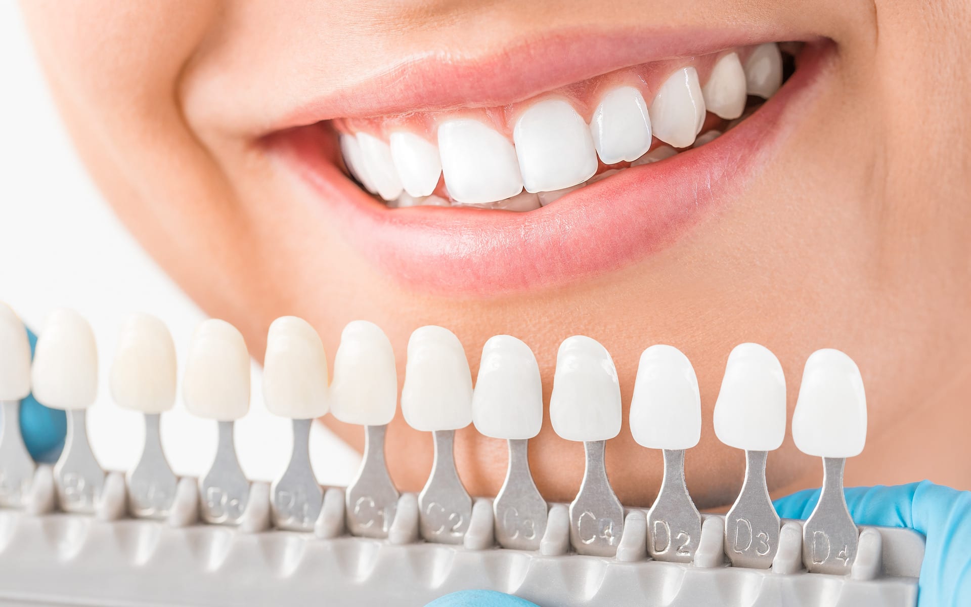 dental implants at Lake Hill Dental Care